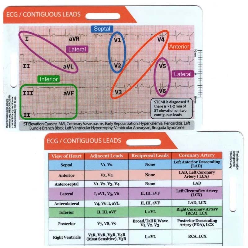 ECG/EKG Rhythm Pocket Card