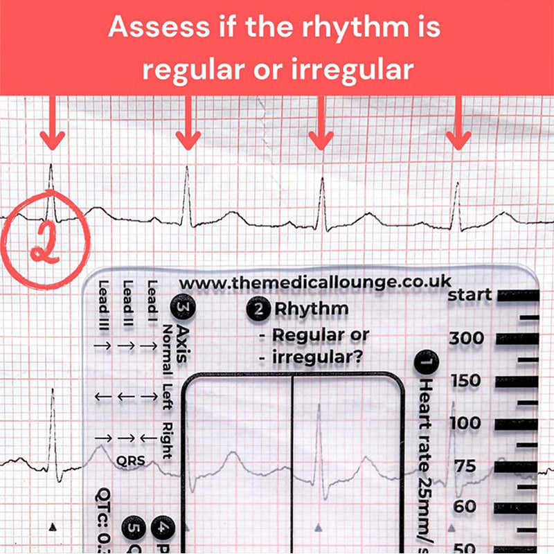 ECG 7 Step Ruler