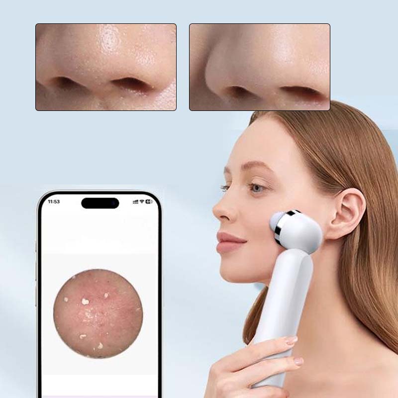 Visible Exfoliator Vacuum Cleaner